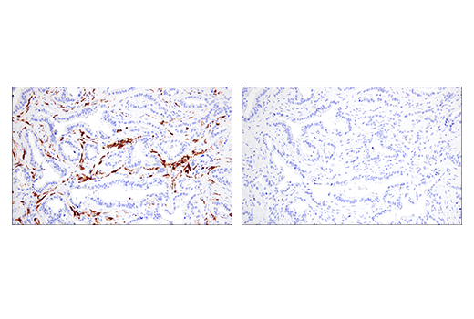 Immunohistochemistry Image 6: Iba1/AIF-1 (E4O4W) Rabbit Monoclonal Antibody (BSA and Azide Free)