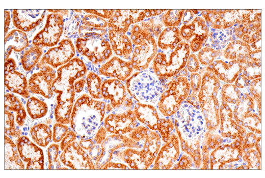 Immunohistochemistry Image 10: SDHB (E3H9Z) Rabbit Monoclonal Antibody