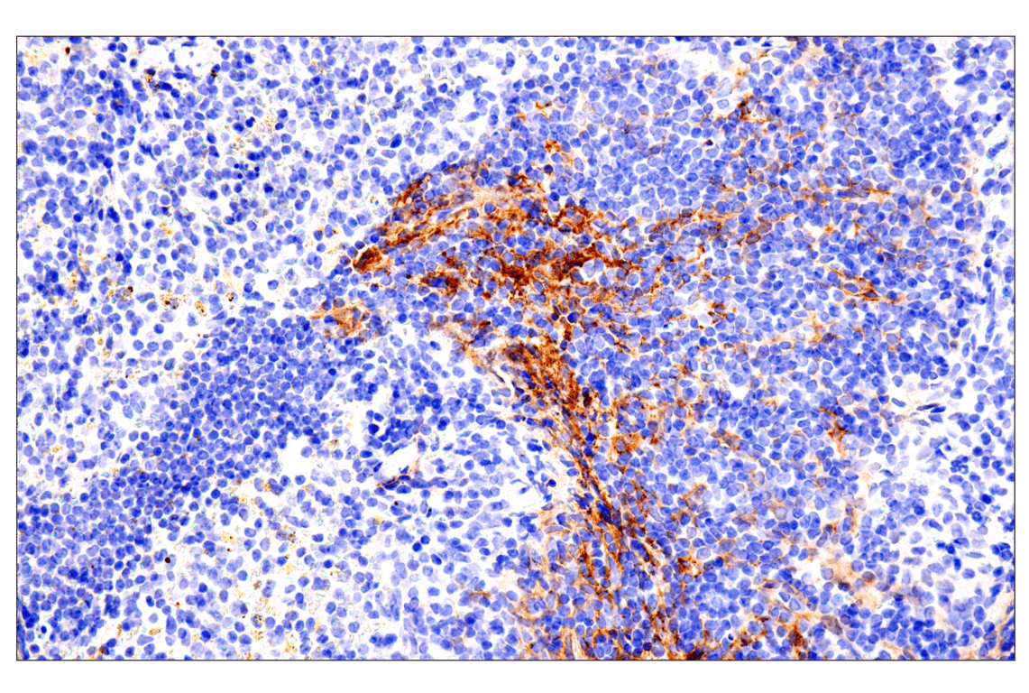 Immunohistochemistry Image 16: p75NTR (E7I3M) Rabbit Monoclonal Antibody (BSA and Azide Free)