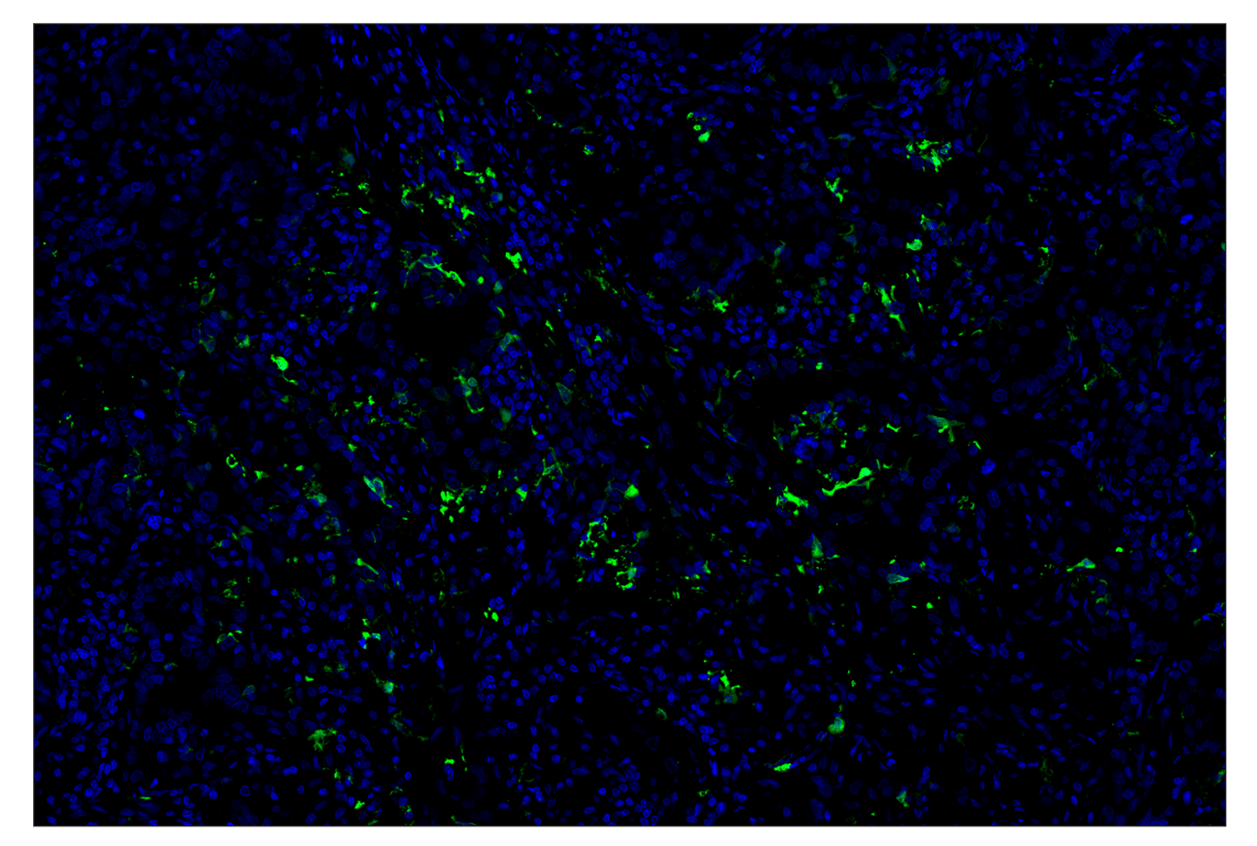 Immunohistochemistry Image 2: S100B (E7C3A) & CO-0126-594 SignalStar<sup>™</sup> Oligo-Antibody Pair