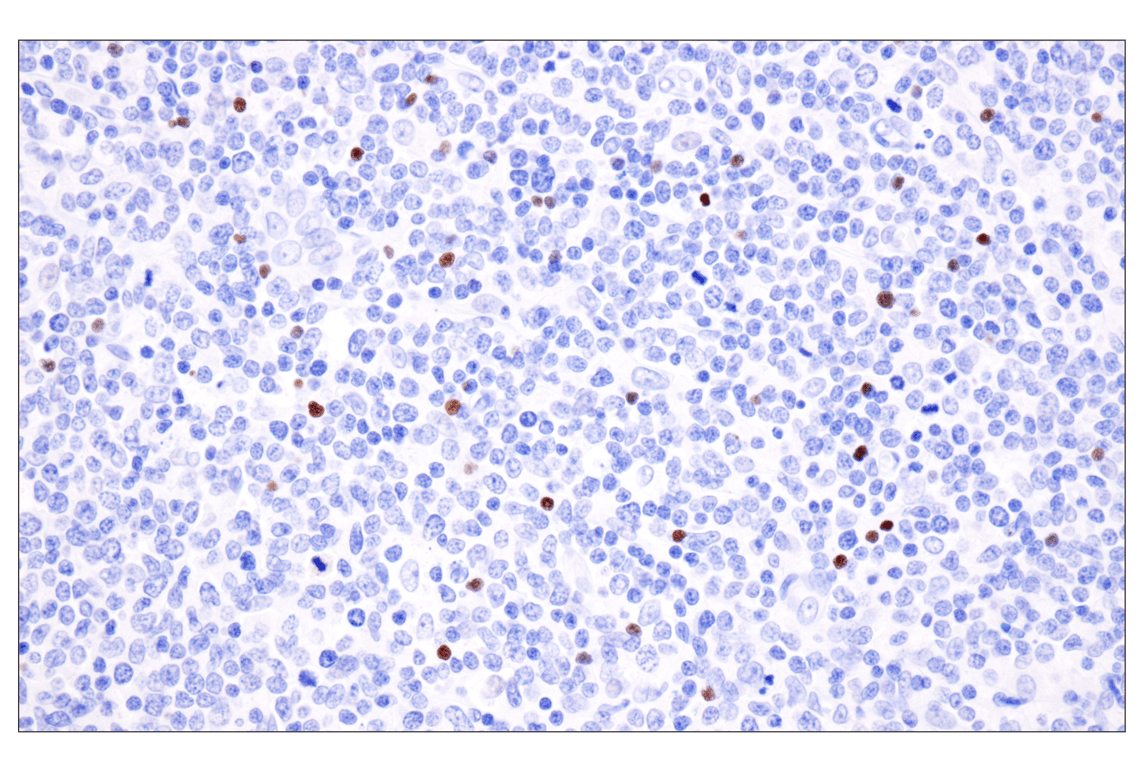 Immunohistochemistry Image 2: FoxP3 (221D) Mouse Monoclonal Antibody