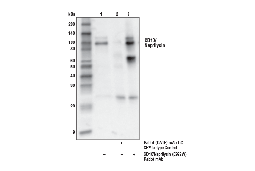 Immunoprecipitation Image 1: CD10/Neprilysin (E9Z2W) Rabbit Monoclonal Antibody