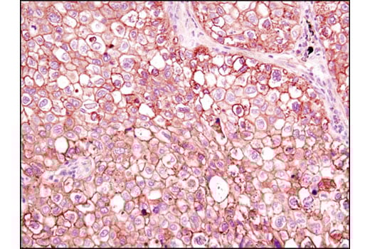 Immunohistochemistry Image 2: Annexin A2 (D11G2) Rabbit Monoclonal Antibody (BSA and Azide Free)