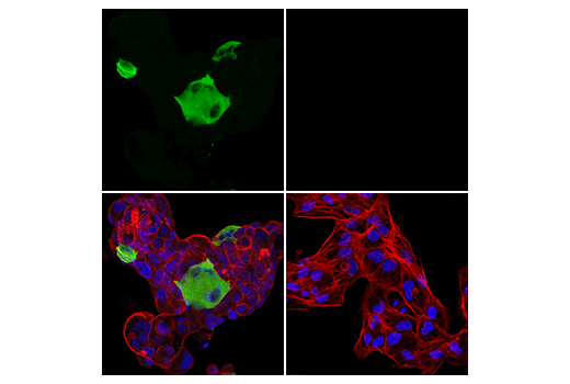 Immunofluorescence Image 1: Tyrosine Hydroxylase (LNC1) Mouse mAb