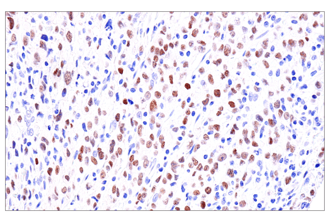Immunohistochemistry Image 3: GATA-6 (D61E4) Rabbit Monoclonal Antibody