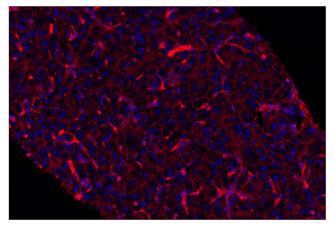 Immunohistochemistry Image 4: CD47 (E2V9V) & CO-0141-647 SignalStar<sup>™</sup> Oligo-Antibody Pair