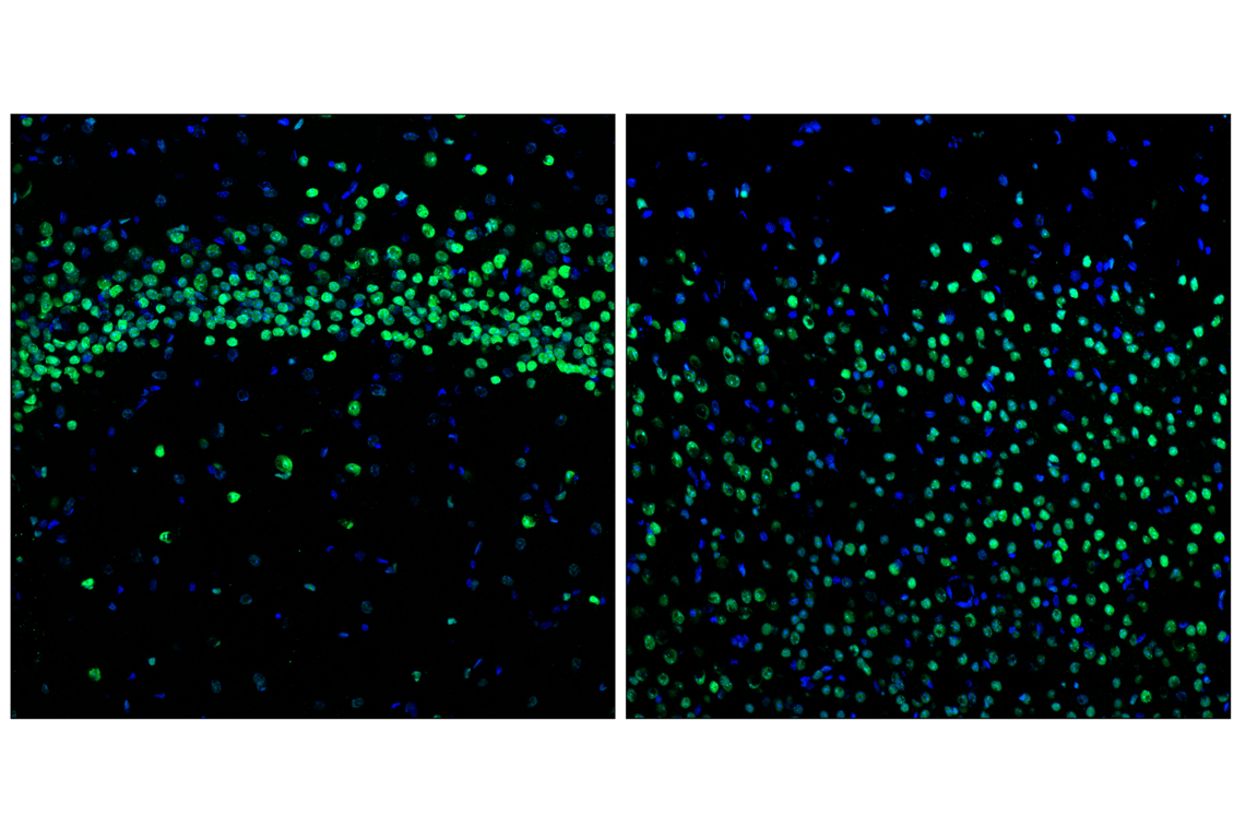 Immunofluorescence Image 1: HP1 alpha (F3K7M) Rabbit Monoclonal Antibody