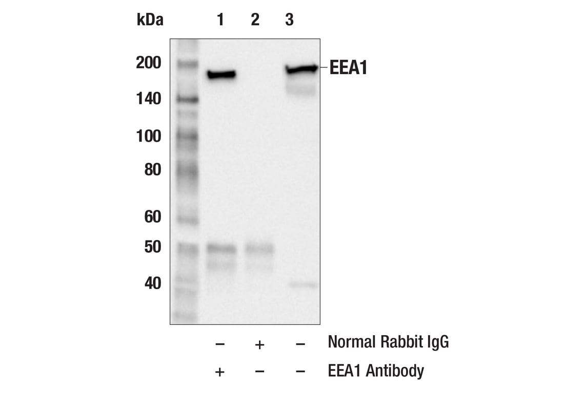 Immunoprecipitation Image 1: EEA1 Antibody