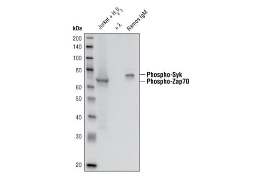 Western Blotting Image 1: Phospho-Zap-70 (Tyr319)/Syk (Tyr352) (65E4) Rabbit mAb