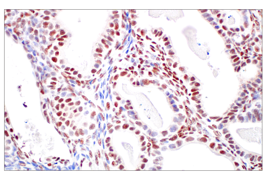 undefined Image 32: ATM Substrates Antibody Sampler Kit