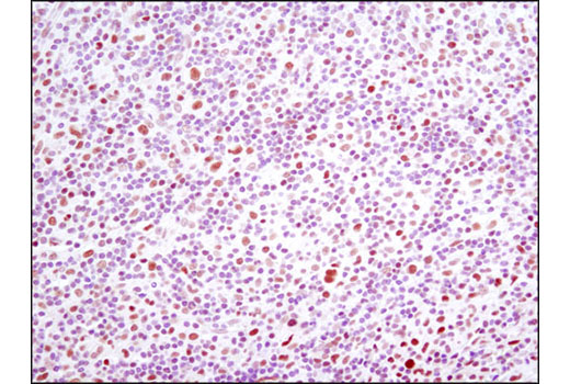 Immunohistochemistry Image 2: IRF-1 (D5E4) Rabbit Monoclonal Antibody (BSA and Azide Free)