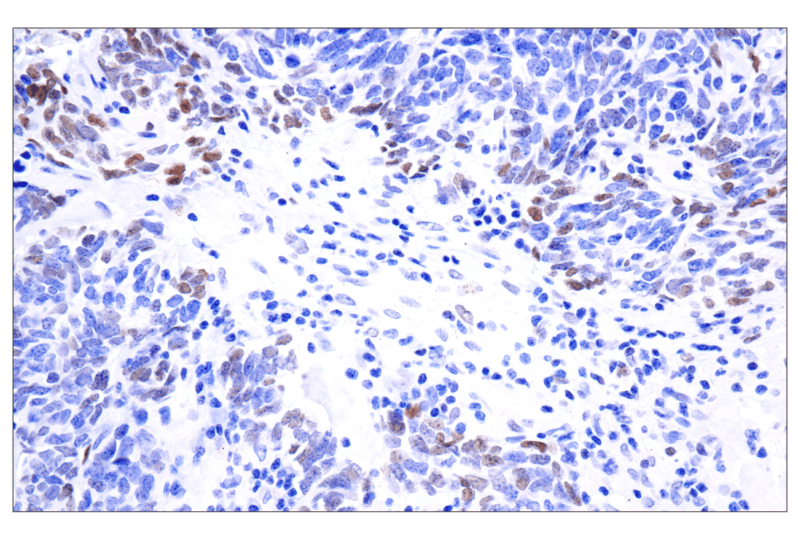Immunohistochemistry Image 2: Phospho-Stat3 (Tyr705) (D3A7) Rabbit Monoclonal Antibody