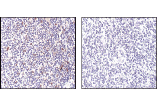 Immunohistochemistry Image 1: Phospho-Stat1 (Tyr701) (58D6) Rabbit Monoclonal Antibody (BSA and Azide Free)