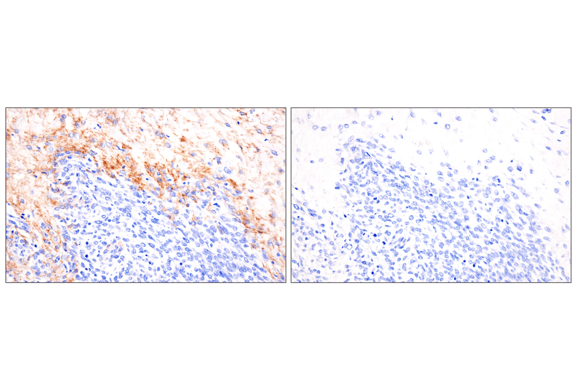 Immunohistochemistry Image 10: LRRC15 (E4X8J) Rabbit Monoclonal Antibody