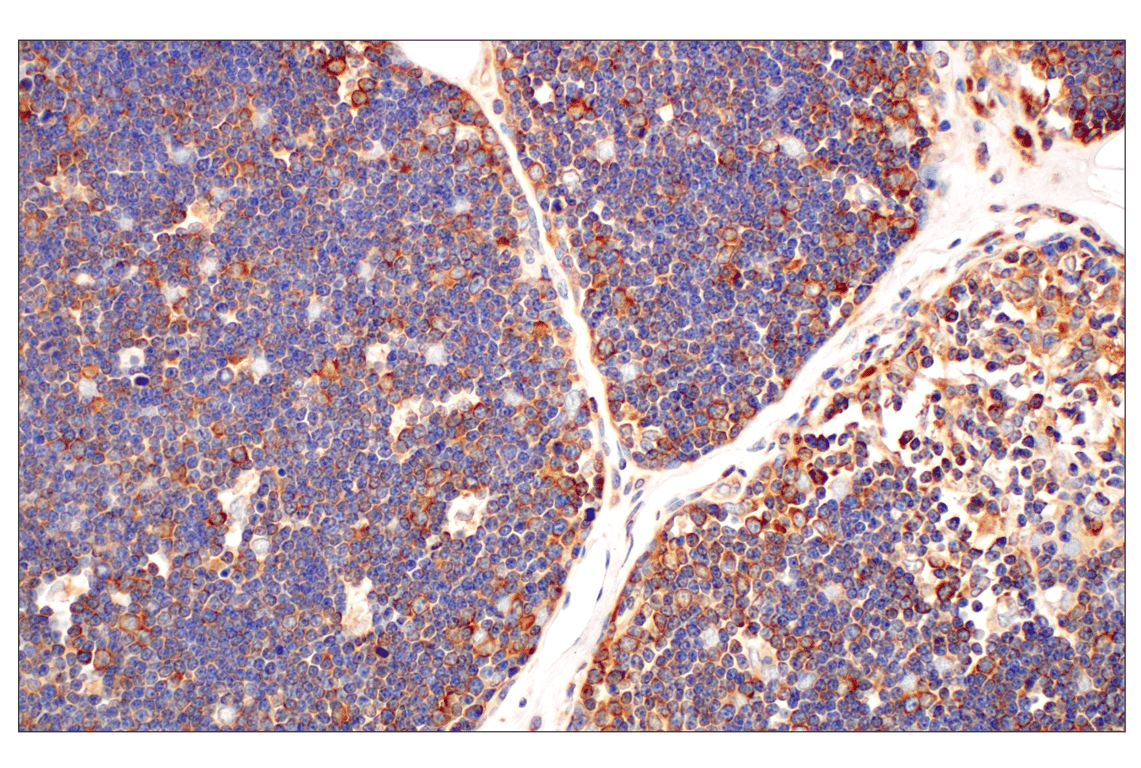 Immunohistochemistry Image 5: RACK1 (D59D5) Rabbit Monoclonal Antibody