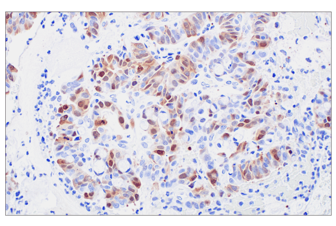 Immunohistochemistry Image 3: PBK/TOPK (F2X2Z) Rabbit Monoclonal Antibody