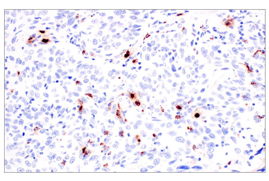 Immunohistochemistry Image 3: Neutrophil Elastase (F4H3X) Rabbit Monoclonal Antibody