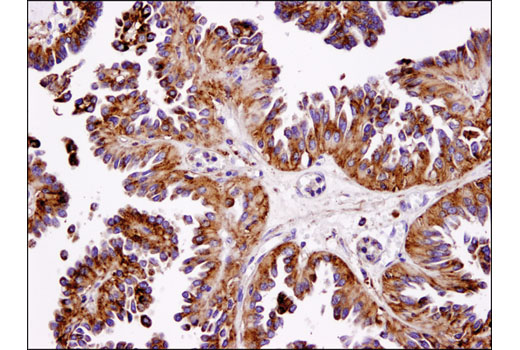 Immunohistochemistry Image 3: LAMP1 (D2D11) Rabbit Monoclonal Antibody (BSA and Azide Free)