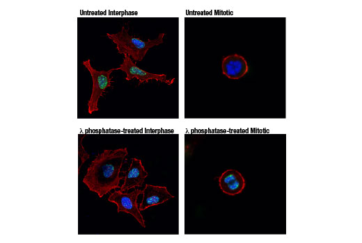 Immunofluorescence Image 1: Tri-Methyl-Histone H3 (Lys9) (D4W1U) Rabbit Monoclonal Antibody