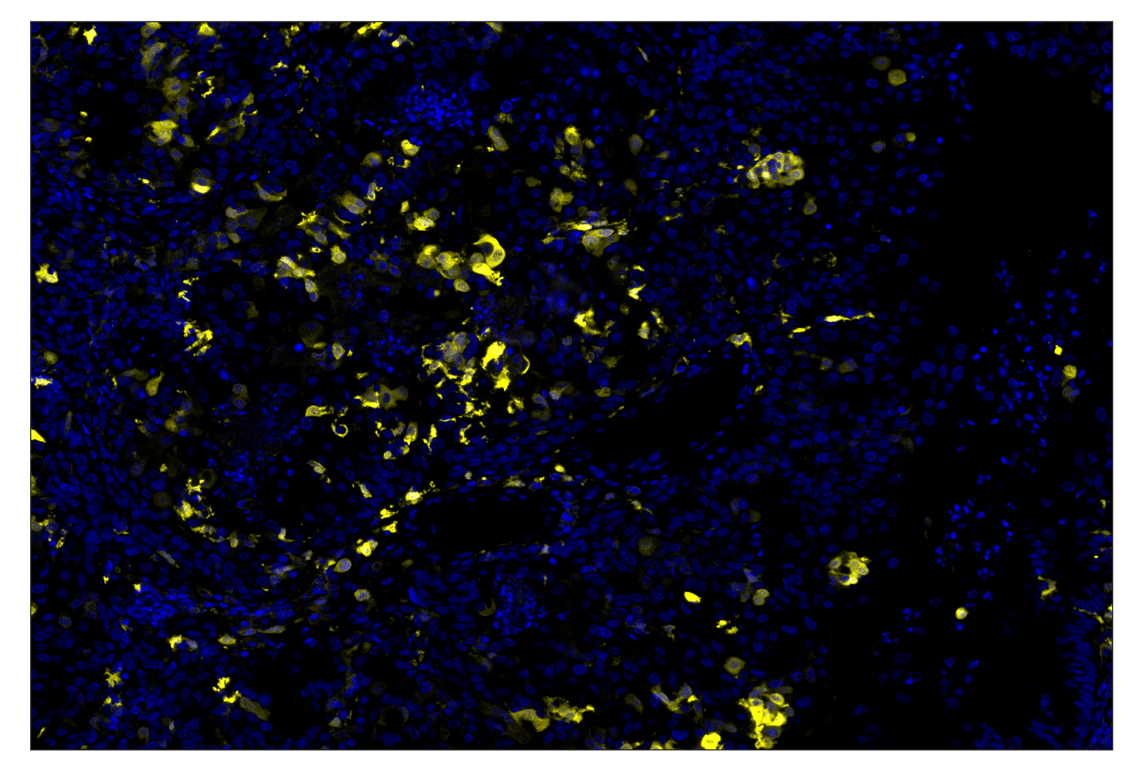 Immunohistochemistry Image 3: S100B (E7C3A) & CO-0126-594 SignalStar<sup>™</sup> Oligo-Antibody Pair