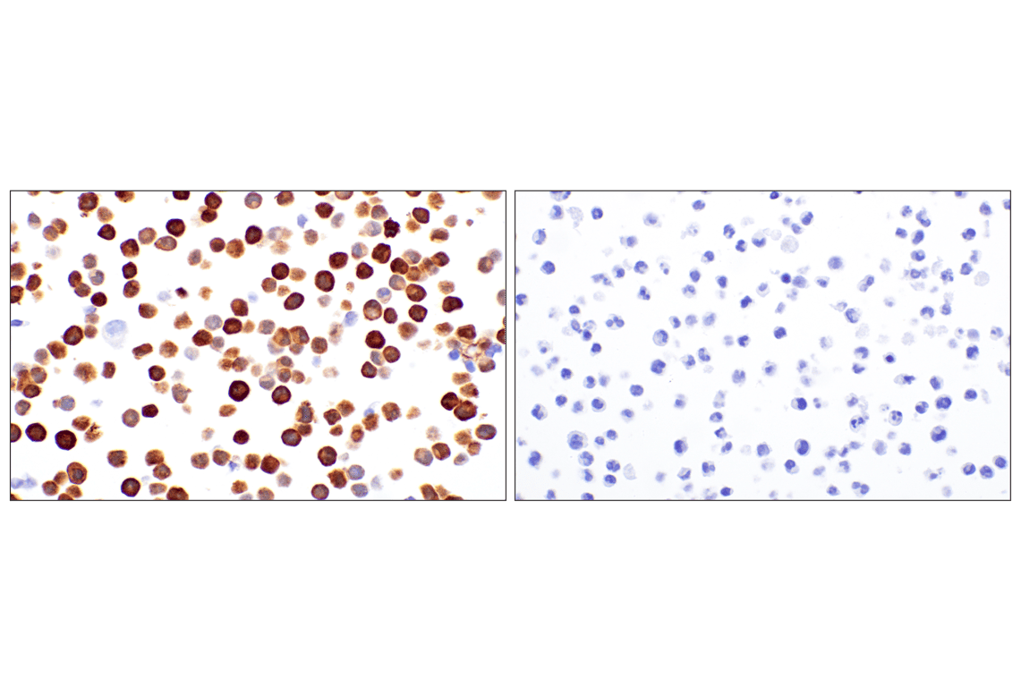 Immunohistochemistry Image 12: PBK/TOPK (F2X2Z) Rabbit Monoclonal Antibody