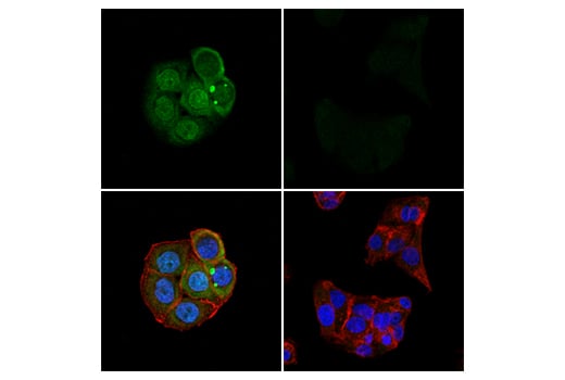 Immunofluorescence Image 1: cGAS (E5V3W) Rabbit Monoclonal Antibody