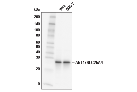 Western Blotting Image 2: ANT1/SLC25A4 (E3E9Y) Rabbit Monoclonal Antibody