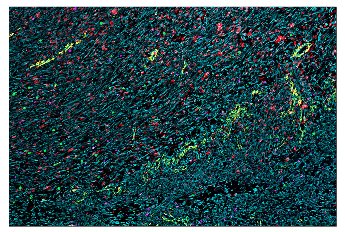 Immunohistochemistry Image 3: HIF-1 alpha (E1V6A) & CO-0117-488 SignalStar<sup>™</sup> Oligo-Antibody Pair