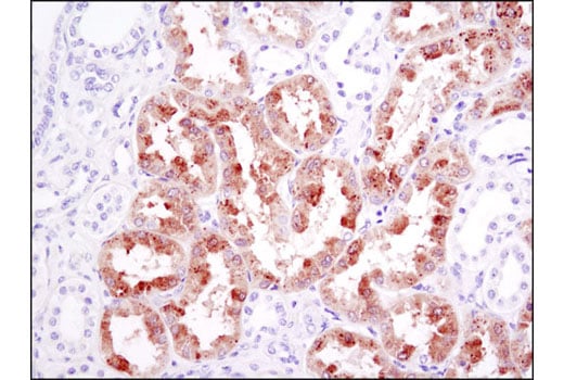 Immunohistochemistry Image 3: FGF Receptor 1 (D8E4) Rabbit Monoclonal Antibody (BSA and Azide Free)