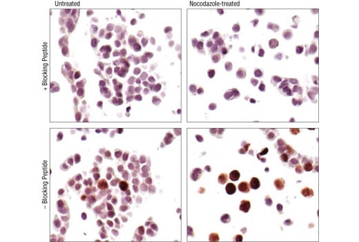 undefined Image 12: Phospho-p53 Antibody Sampler Kit