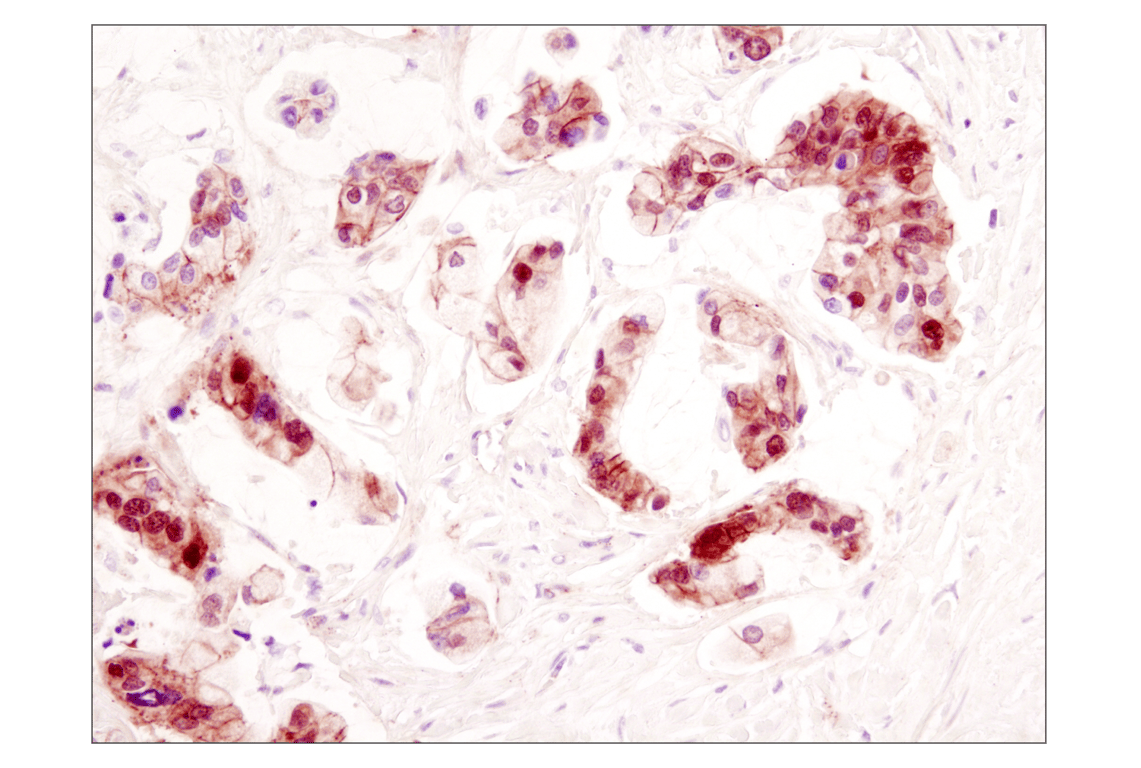 Immunohistochemistry Image 2: beta-Catenin (D10A8) Rabbit Monoclonal Antibody (BSA and Azide Free)