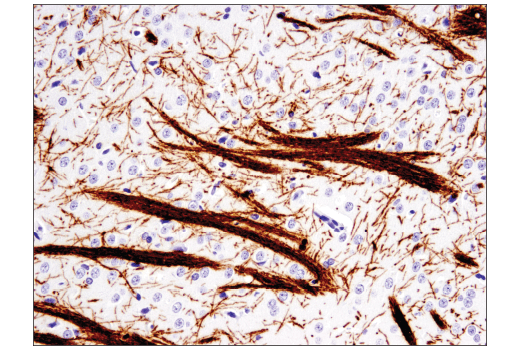 Immunohistochemistry Image 4: MOG (E5K6T) Rabbit Monoclonal Antibody (BSA and Azide Free)