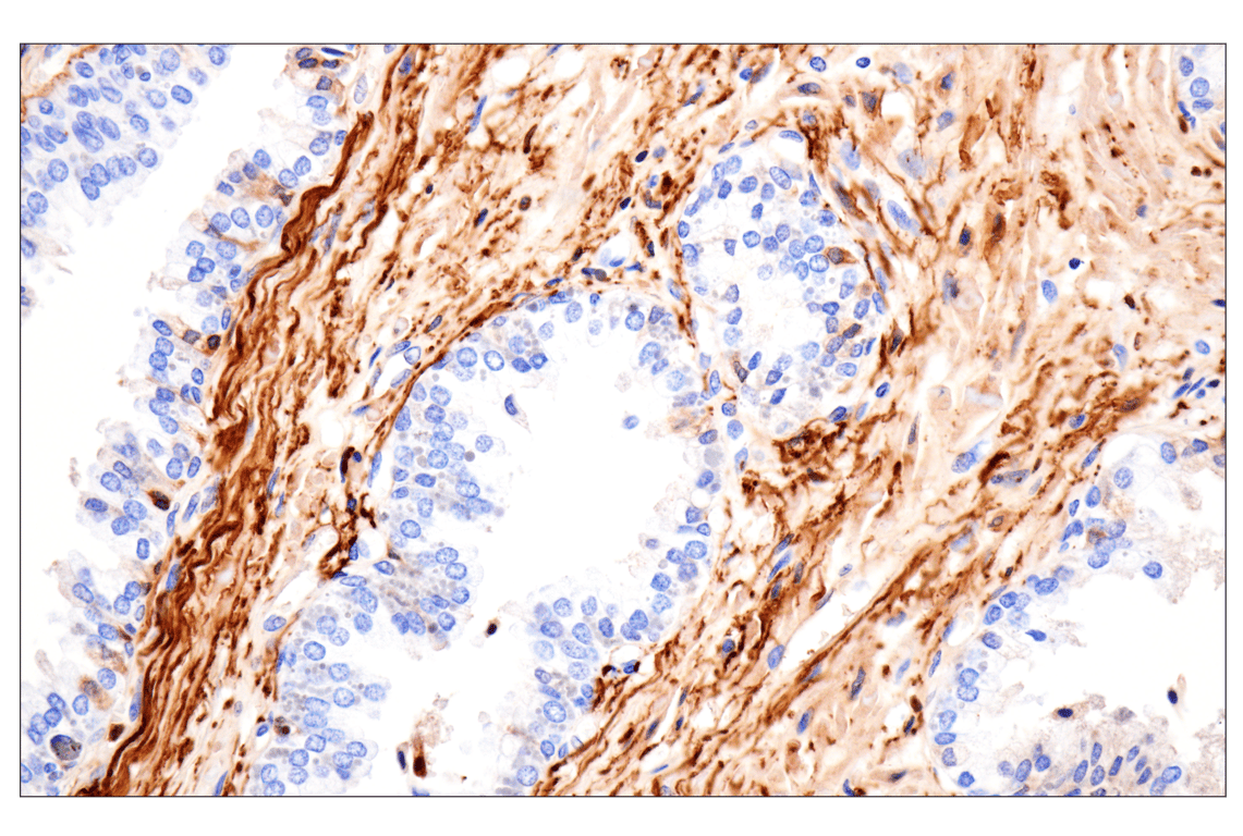 Immunohistochemistry Image 5: Vitronectin (F8D3L) Rabbit Monoclonal Antibody