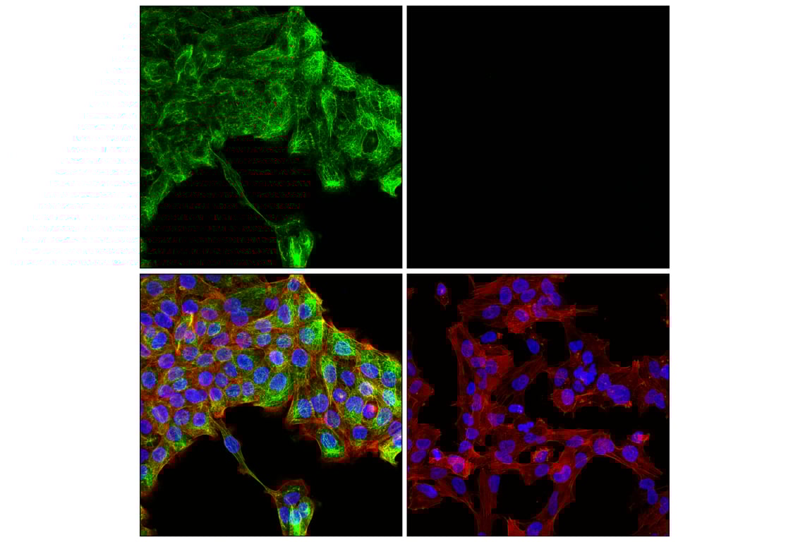 Immunofluorescence Image 1: Keratin 14 (E7W6V) Rabbit Monoclonal Antibody