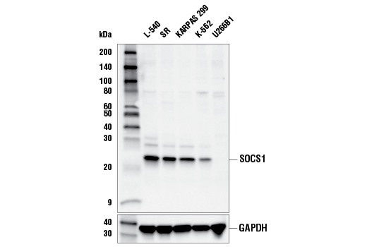 Western Blotting Image 1: SOCS1 (E4K7Q) Rabbit mAb