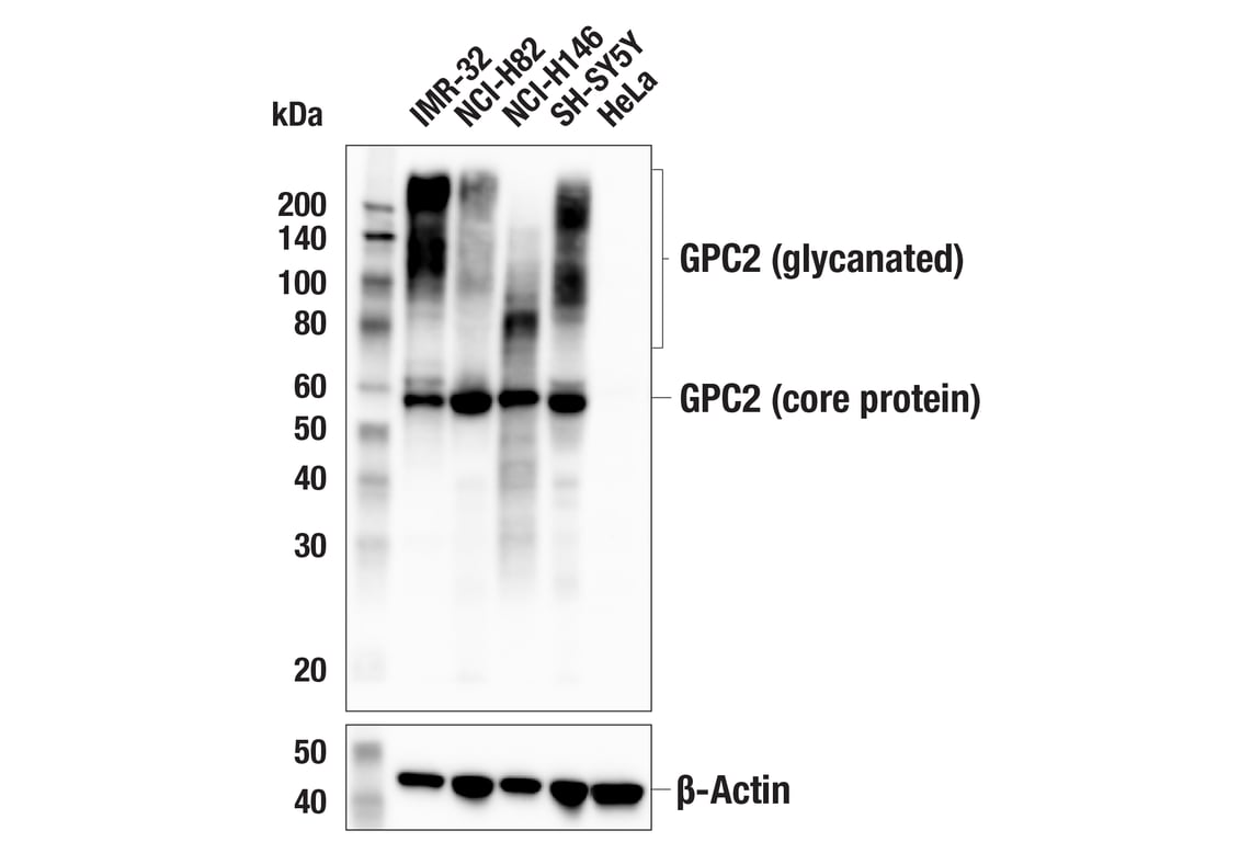 Western Blotting Image 1: GPC2 (CT3) Mouse mAb