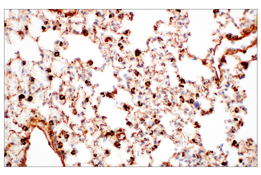 Immunohistochemistry Image 5: EphA2 (D4A2) Rabbit Monoclonal Antibody (BSA and Azide Free)