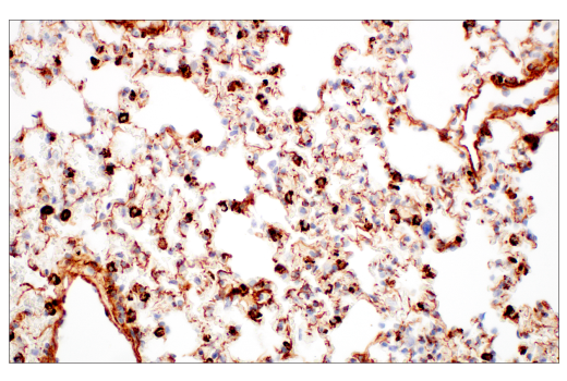 Immunohistochemistry Image 5: EphA2 (D4A2) XP<sup>®</sup> Rabbit mAb (BSA and Azide Free)