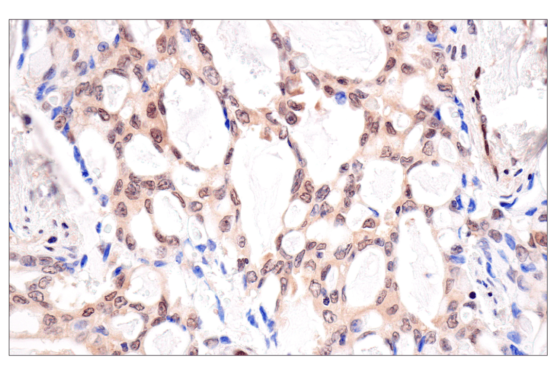Immunohistochemistry Image 4: CRBN (F4I7F) Rabbit mAb