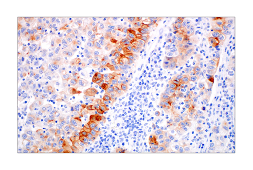 Immunohistochemistry Image 3: ACE2 (OTI1G4) Mouse Monoclonal Antibody