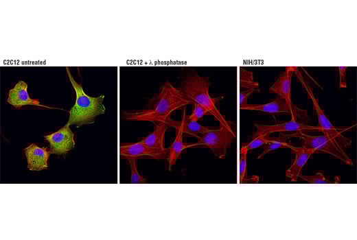 Immunofluorescence Image 1: Phospho-HSP27 (Ser82) (D1H2F6) Rabbit Monoclonal Antibody (BSA and Azide Free)