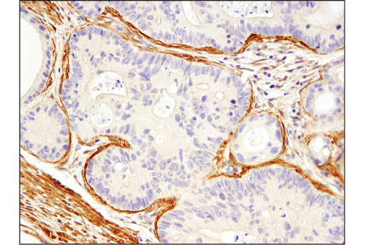 Immunohistochemistry Image 2: Palladin (D9H2) Rabbit Monoclonal Antibody