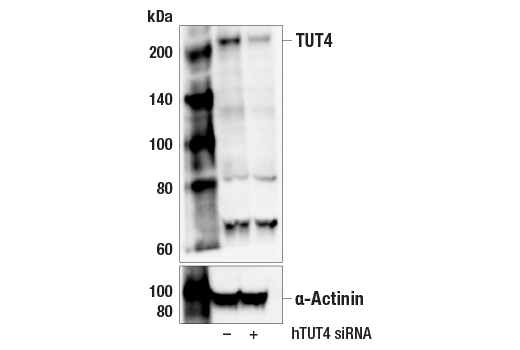 Western Blotting Image 2: TUT4 (E9D9T) Rabbit Monoclonal Antibody