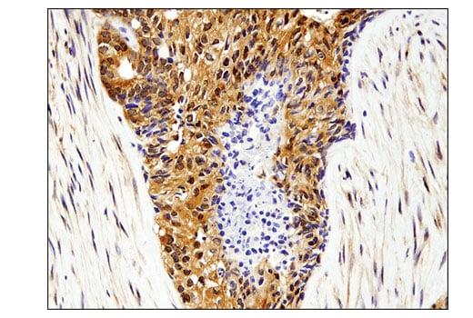Immunohistochemistry Image 3: Akt1 (D9R8K) Rabbit Monoclonal Antibody