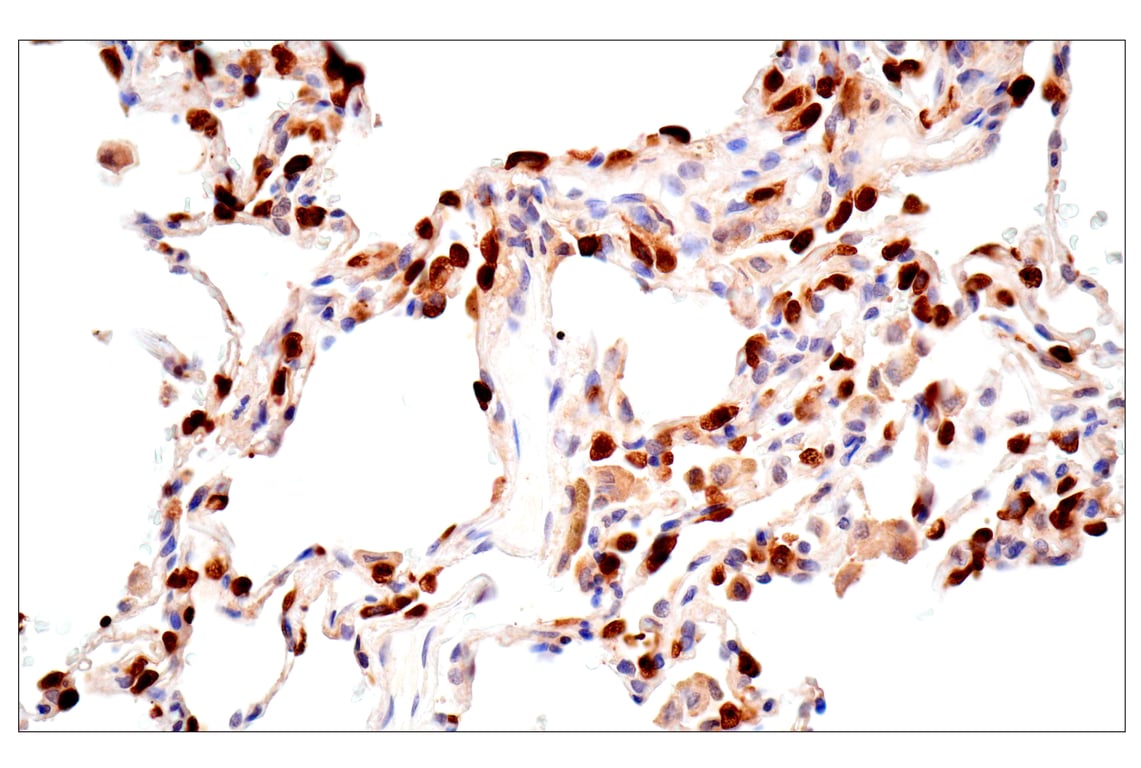 Immunohistochemistry Image 7: ACBP/DBI (E6K8G) Rabbit Monoclonal Antibody