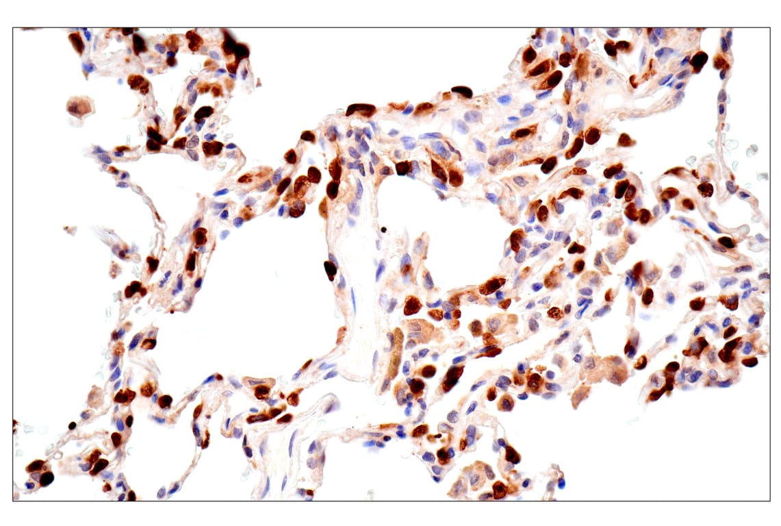 Immunohistochemistry Image 7: ACBP/DBI (E6K8G) XP<sup>®</sup> Rabbit mAb