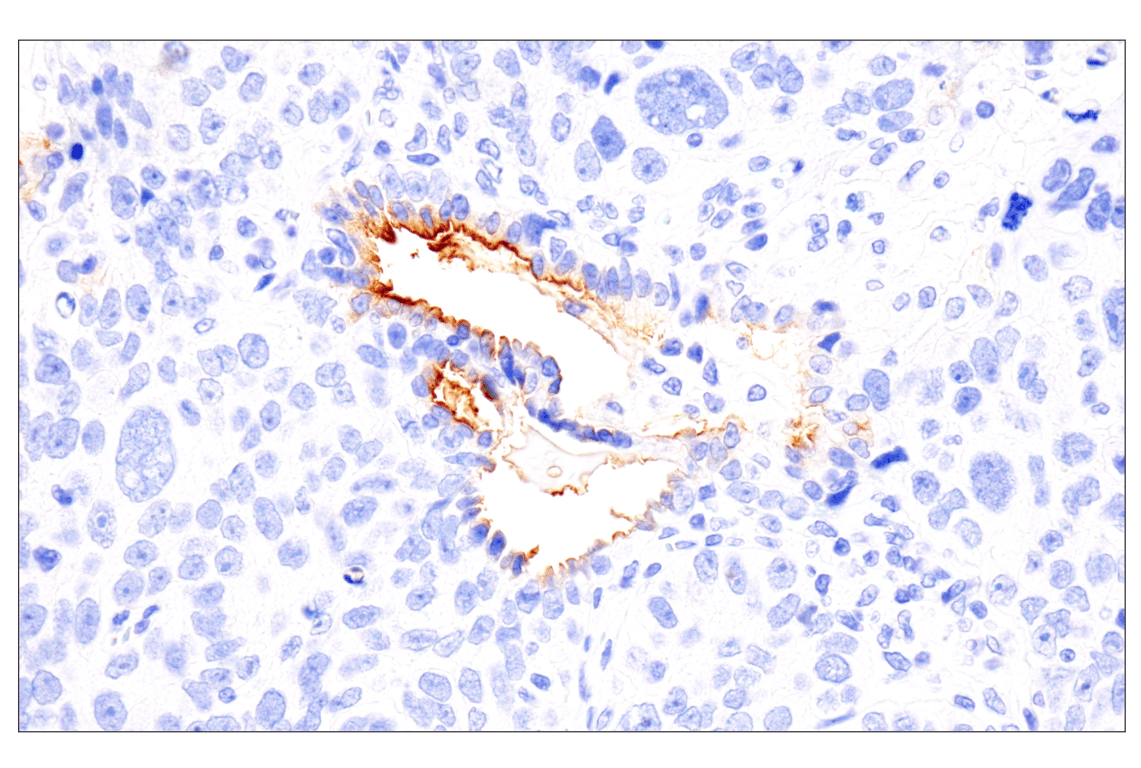 Immunohistochemistry Image 7: Folate Receptor Alpha/FOLR1 (BN3.2) Mouse Monoclonal Antibody