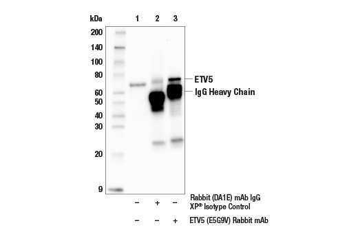 Immunoprecipitation Image 1: ETV5 (E5G9V) Rabbit Monoclonal Antibody