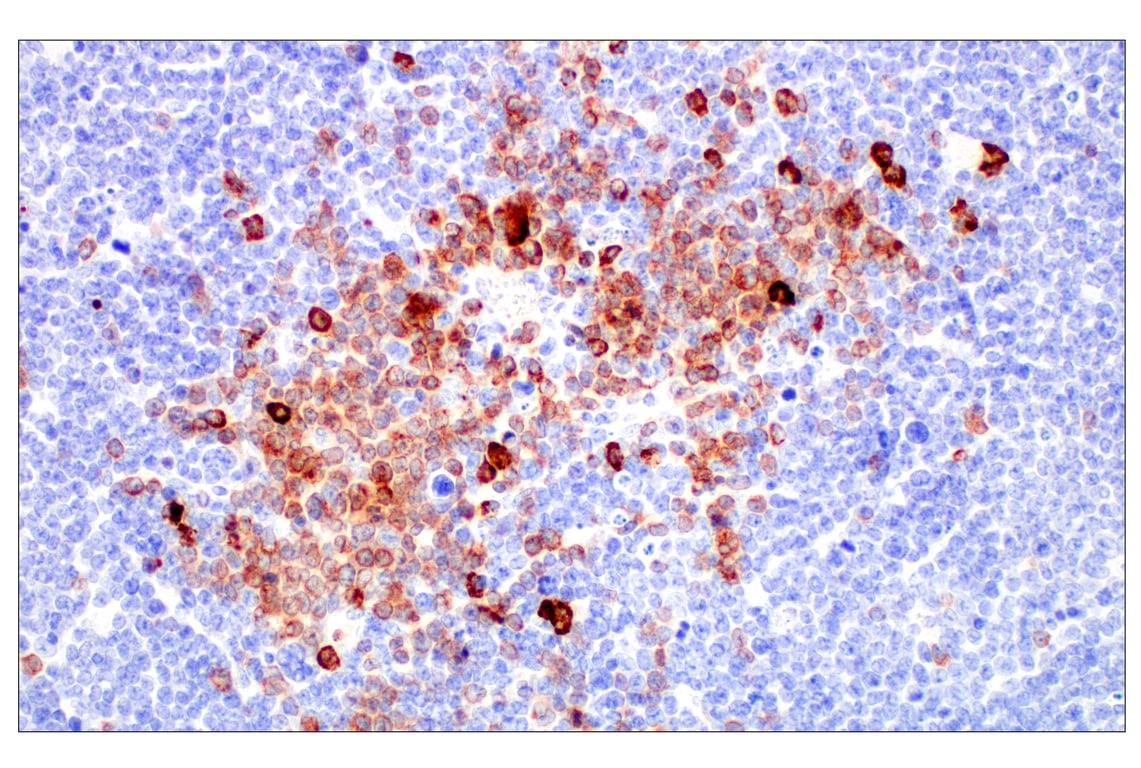 Immunohistochemistry Image 1: IgM (E8M1B) Rabbit Monoclonal Antibody (BSA and Azide Free)