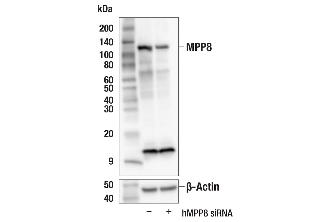 Western Blotting Image 2: MPP8 (F4Z4O) Rabbit Monoclonal Antibody